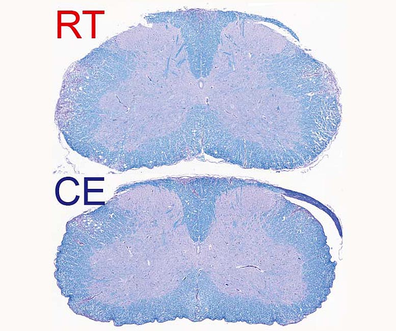 Médula espinal desmielinizada de ratones que padecen una enfermedad autoinmune. Arriba, a temperatura ambiente, y abajo, expuestas al frío. La mielina está coloreada de azul. La tinción violeta dentro de la sustancia blanca (partes hacia el borde del corte histológico) muestra lesiones desmielinizadas que se reducen en la imagen inferior. Crédito: © UNIGE - Laboratoires Trajkovski & Merkler / Cell Metabolism