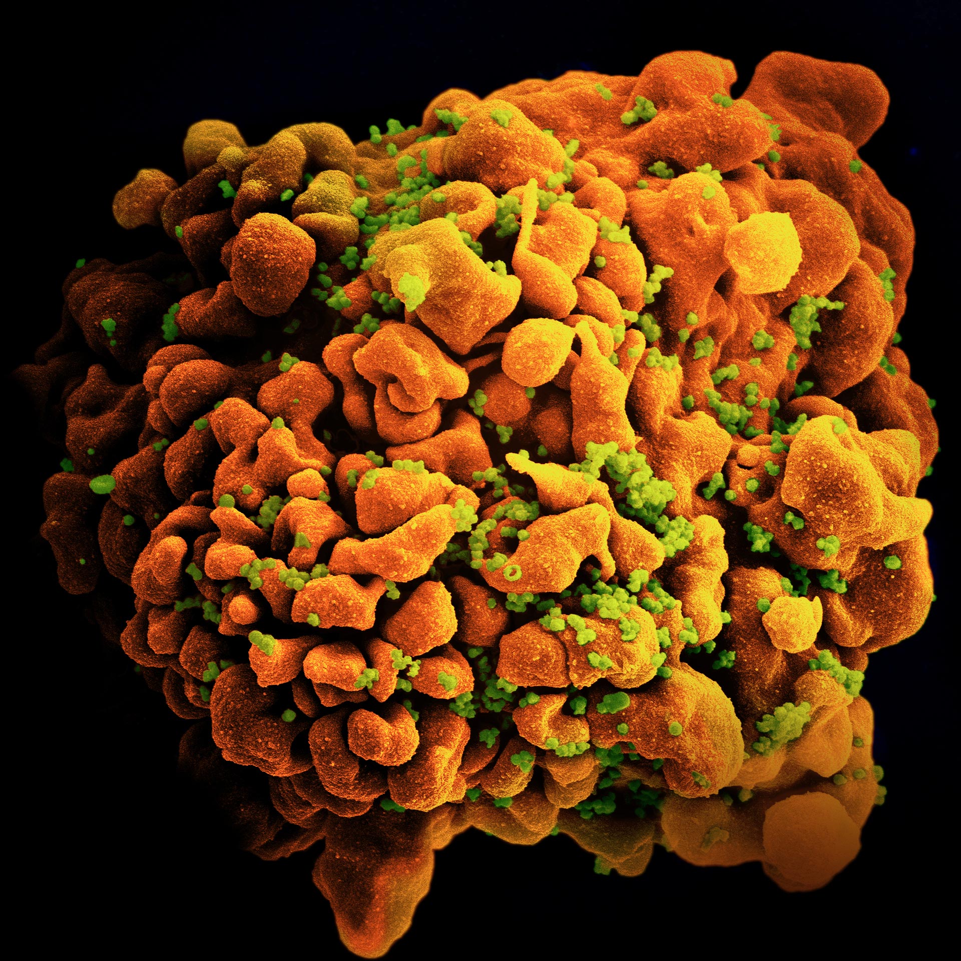 Micrografía electrónica de barrido de una célula T H9 infectada con VIH. Crédito: NIAID